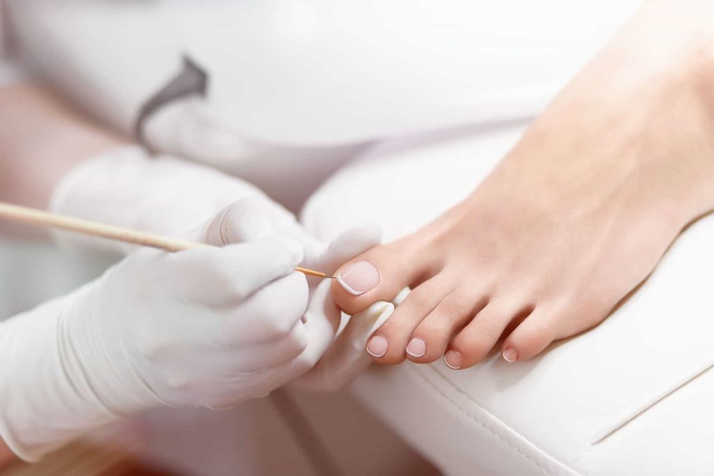 Pedicure curativa